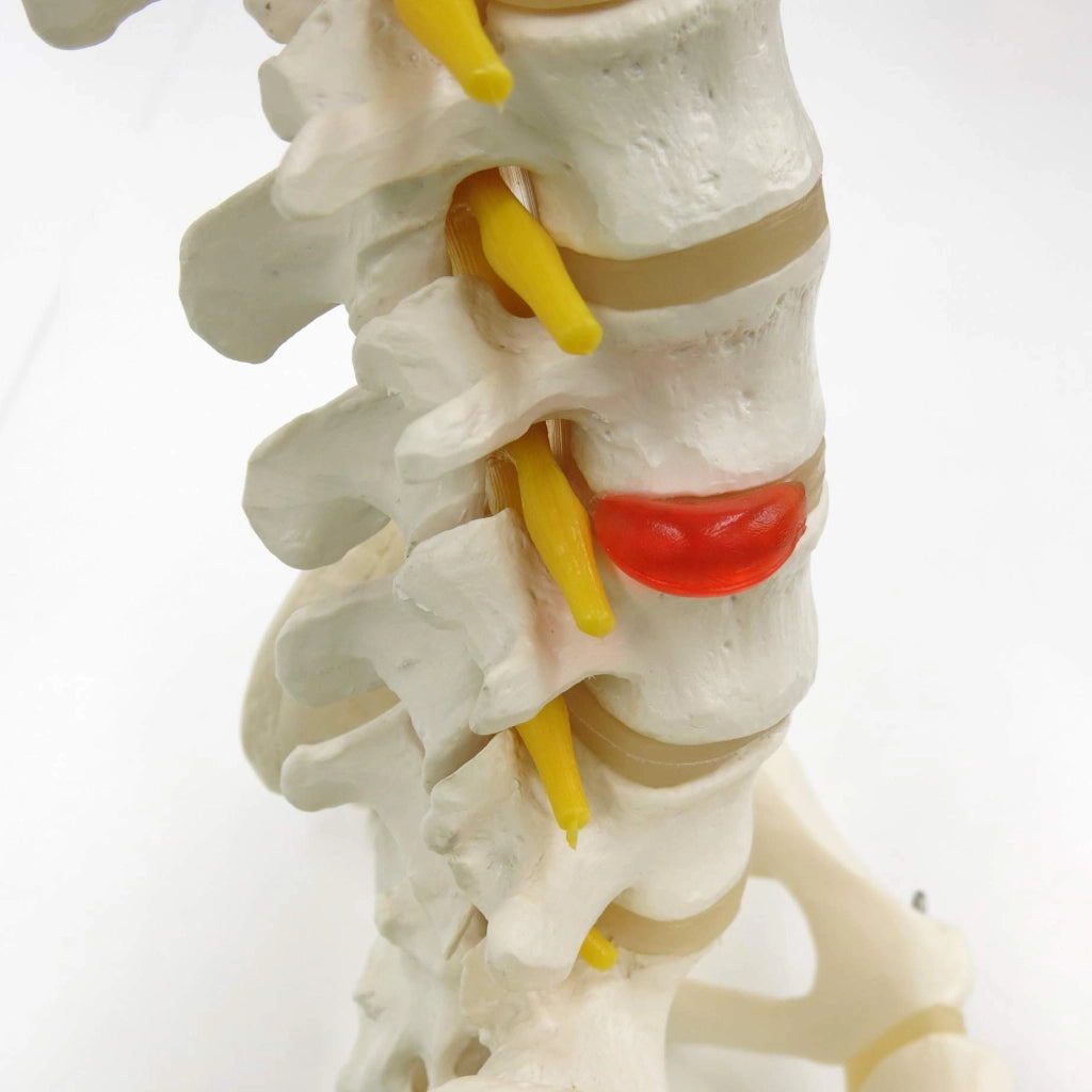 Modello classico di colonna vertebrale flessibile, completo di supporti per il femore